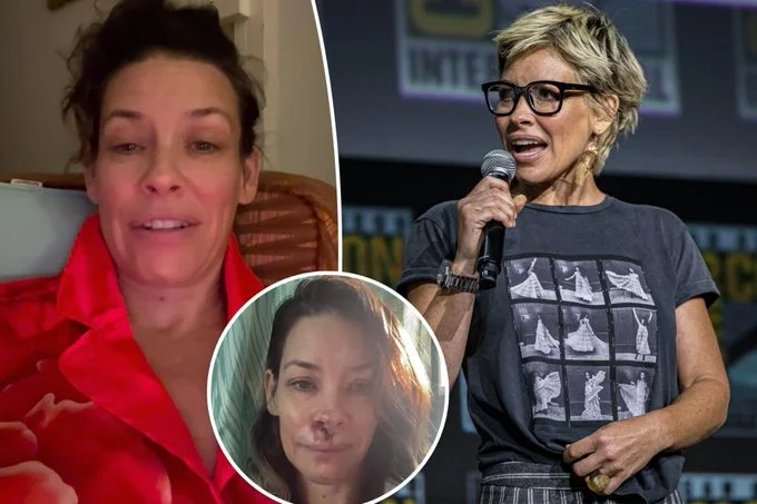 evangeline lilly brain damage